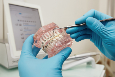 Dentist demonstrating braces on a model of the teeth