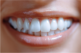After_Smile