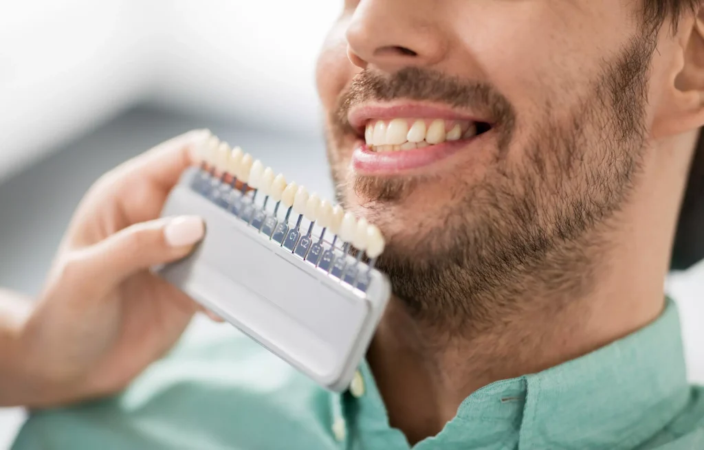 Smile Makeover Post