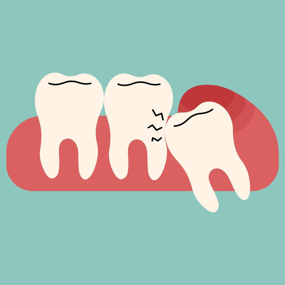 Wisdom Teeth Removal Blog