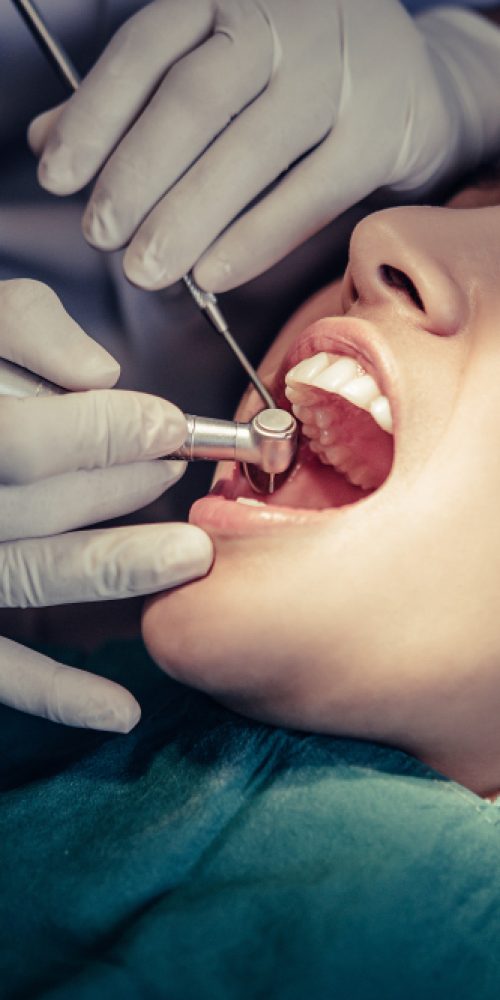 Root Canal Treatment